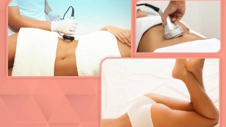 body sculpting without surgery, Body sculpting, Lipocavitation and Radiofrequency